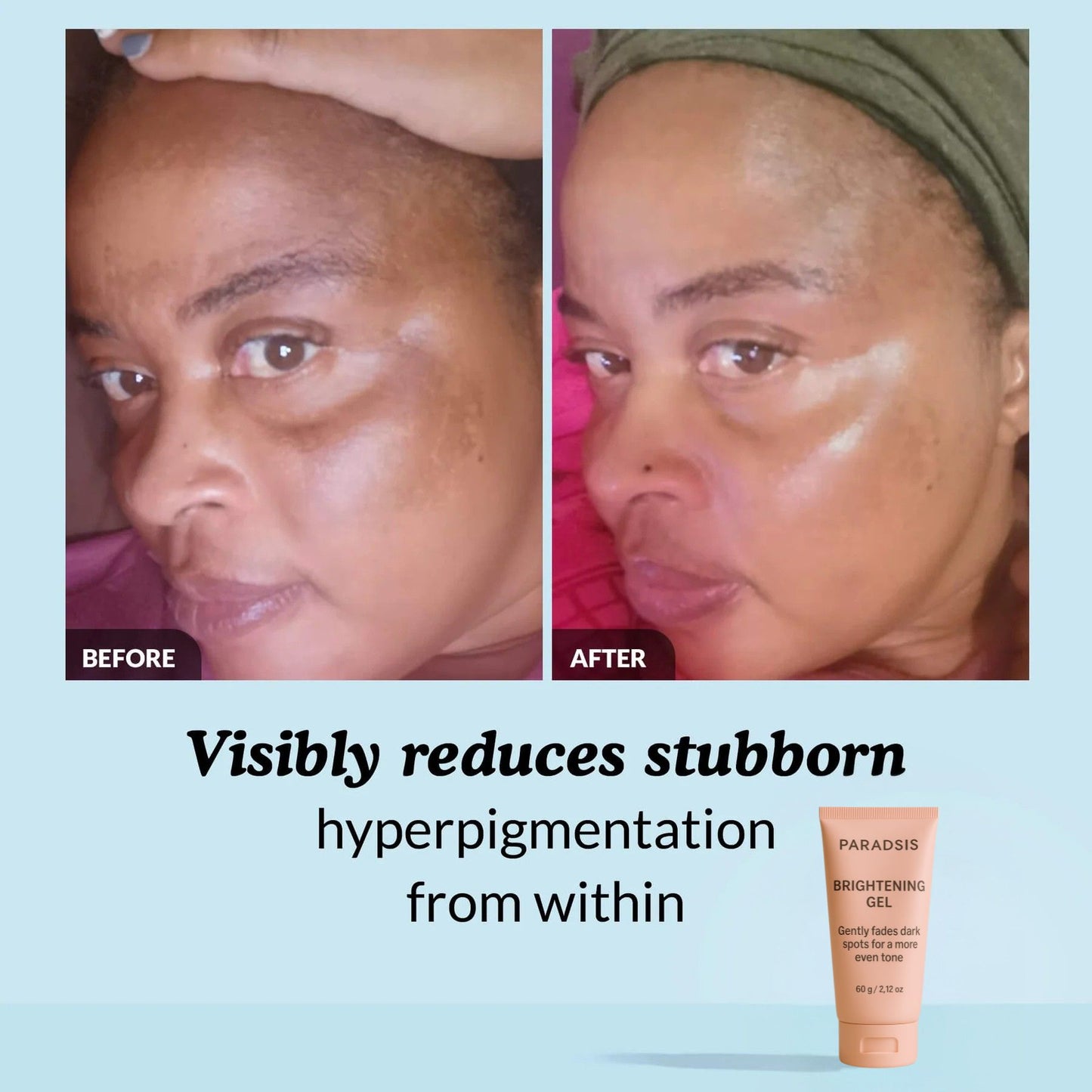 PARADSIS™ Brightening Gel
