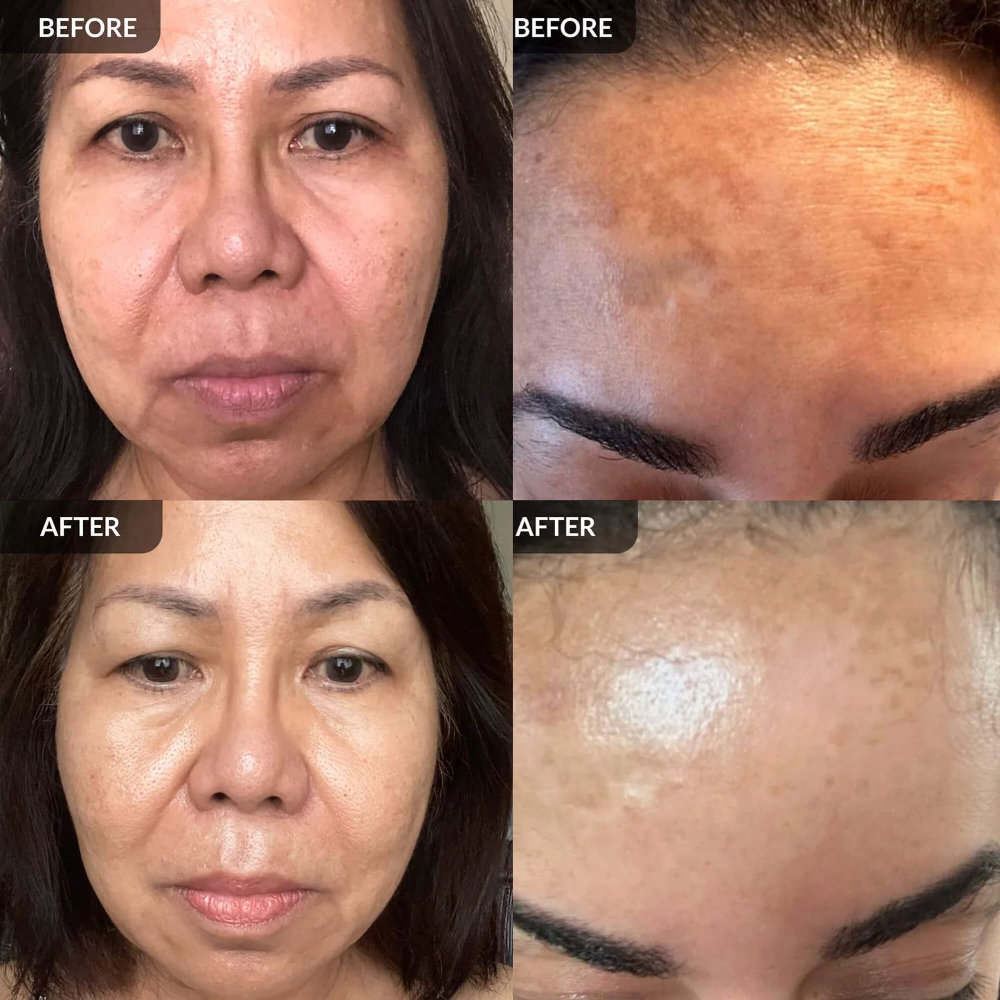 PARADSIS™ Brightening Gel