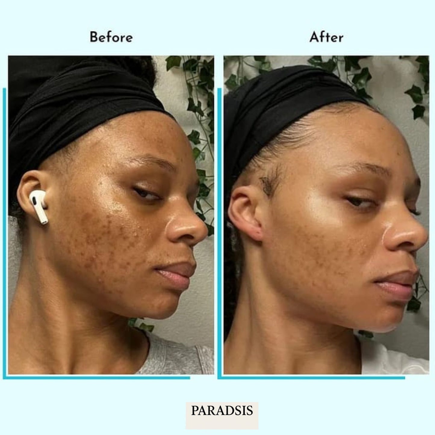 PARADSIS™ Brightening Gel