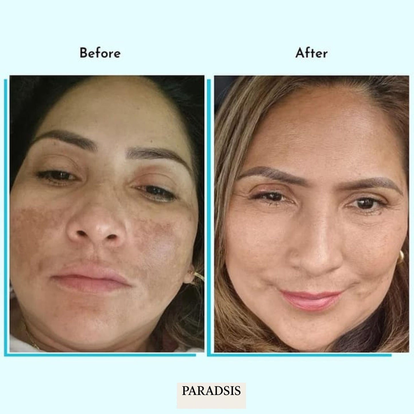 PARADSIS™ Brightening Gel