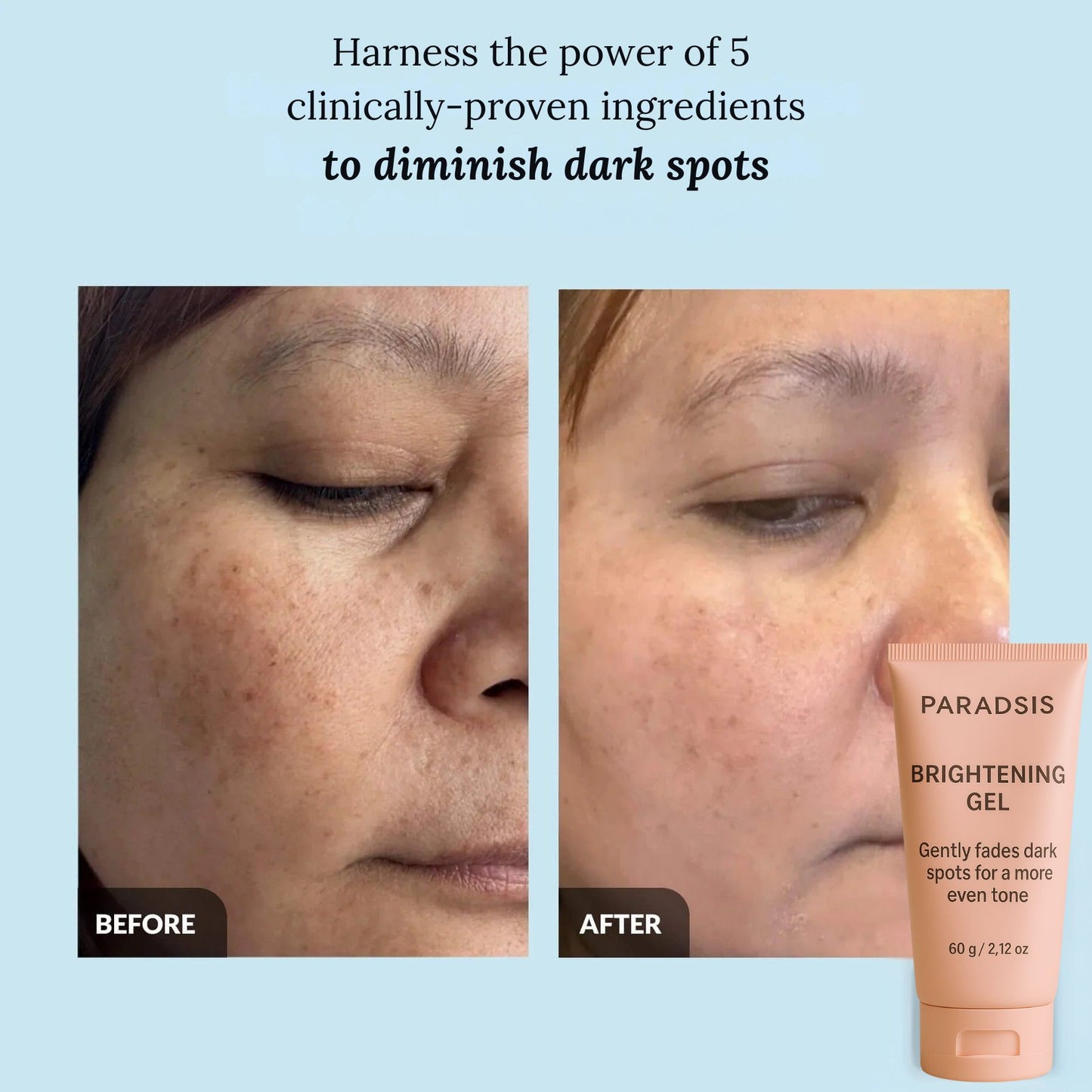PARADSIS™ Brightening Gel