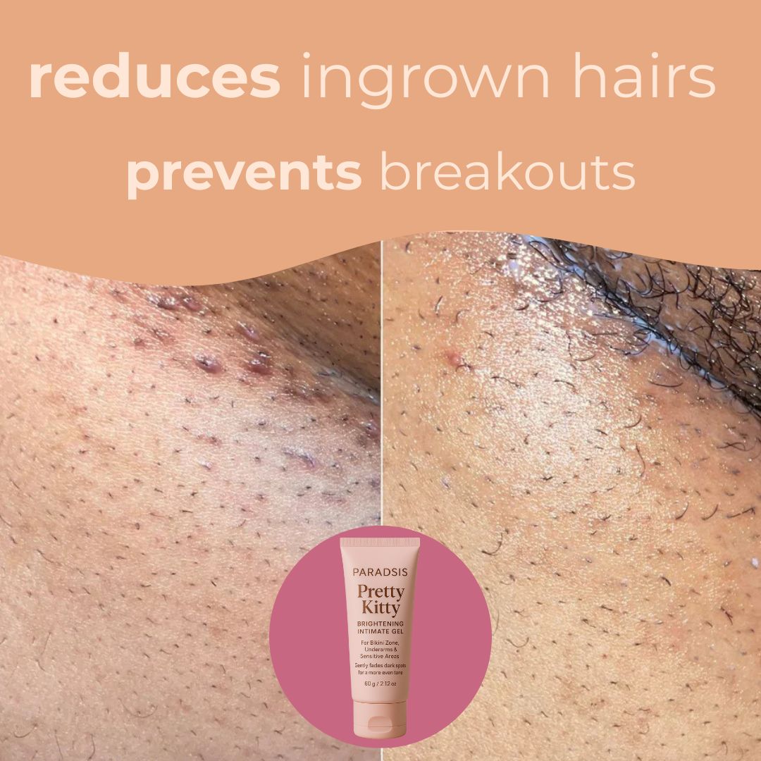 PARADSIS™ Brightening Gel