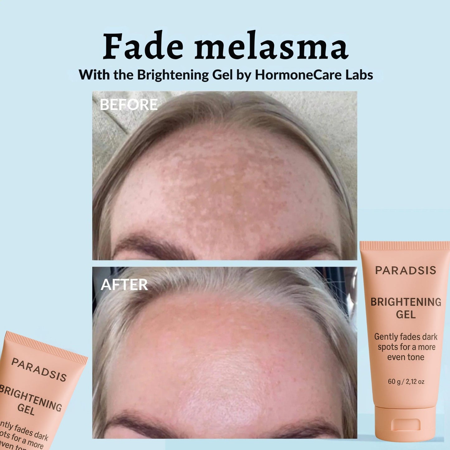 PARADSIS™ Brightening Gel