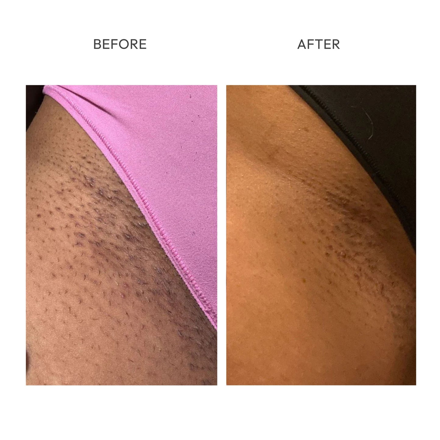 PARADSIS™ Brightening Gel