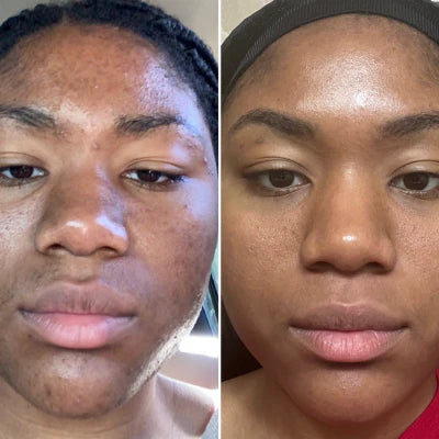 PARADSIS™ Brightening Gel