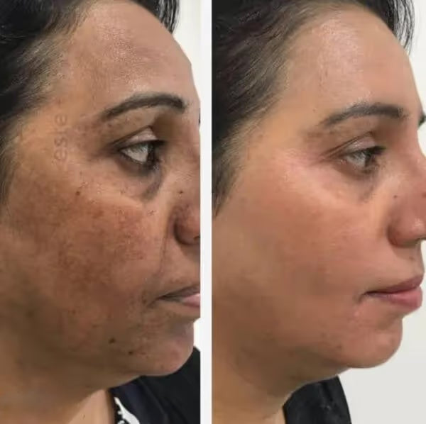 PARADSIS™ Brightening Gel