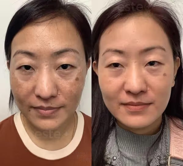 PARADSIS™ Brightening Gel