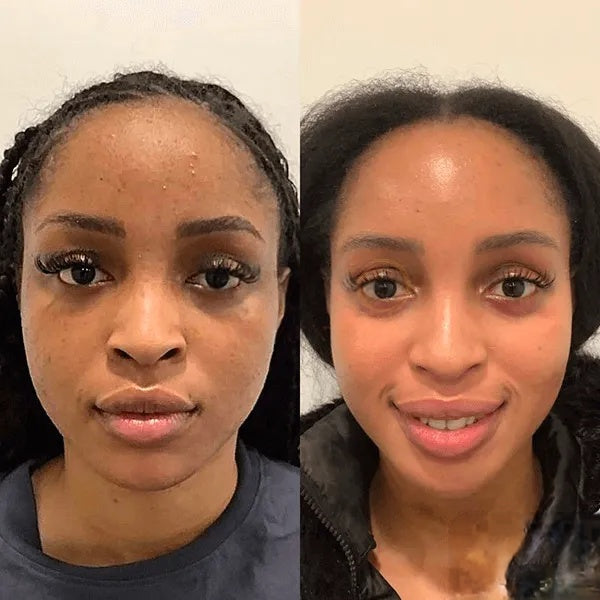 PARADSIS™ Brightening Gel