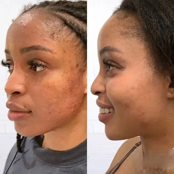 PARADSIS™ Brightening Gel