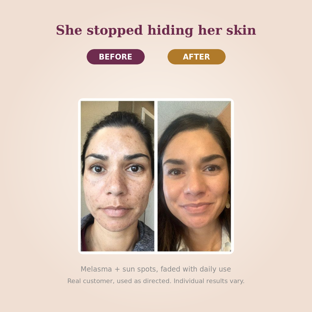 PARADSIS™ Brightening Gel By HormoneCareLab