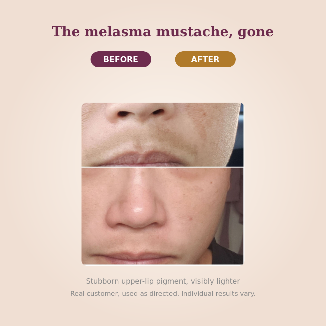 PARADSIS™ Brightening Gel By HormoneCareLab
