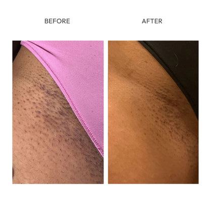 PARADSIS™ Brightening Gel