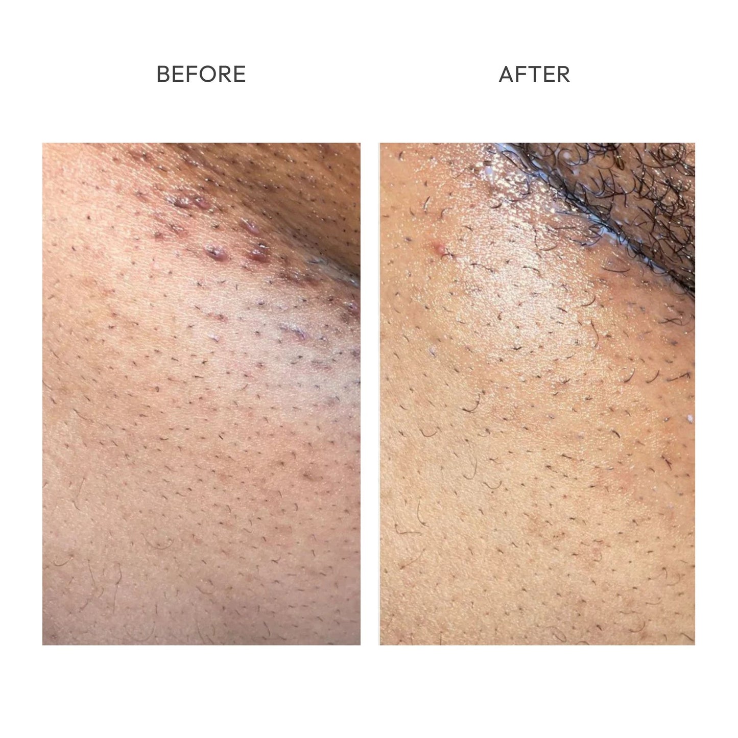 PARADSIS™ Brightening Gel