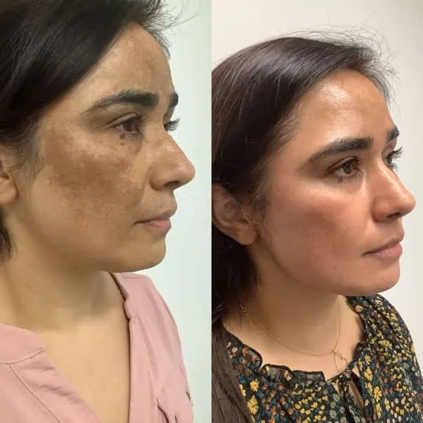 PARADSIS™ Brightening Gel