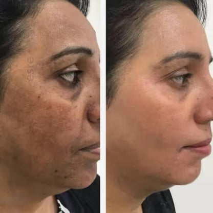 PARADSIS™ Brightening Gel