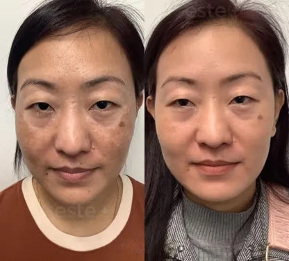 PARADSIS™ Brightening Gel